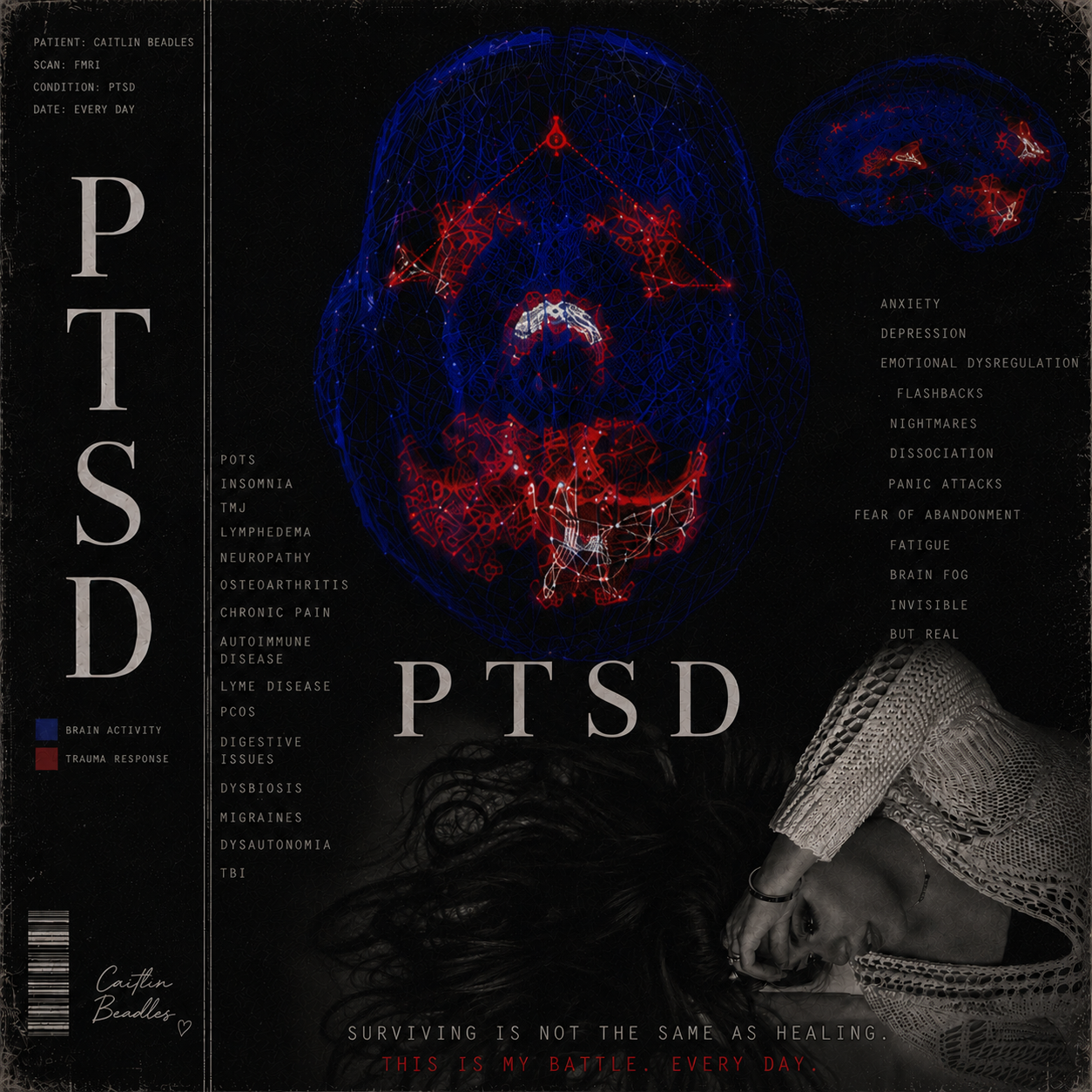PTSD song cover