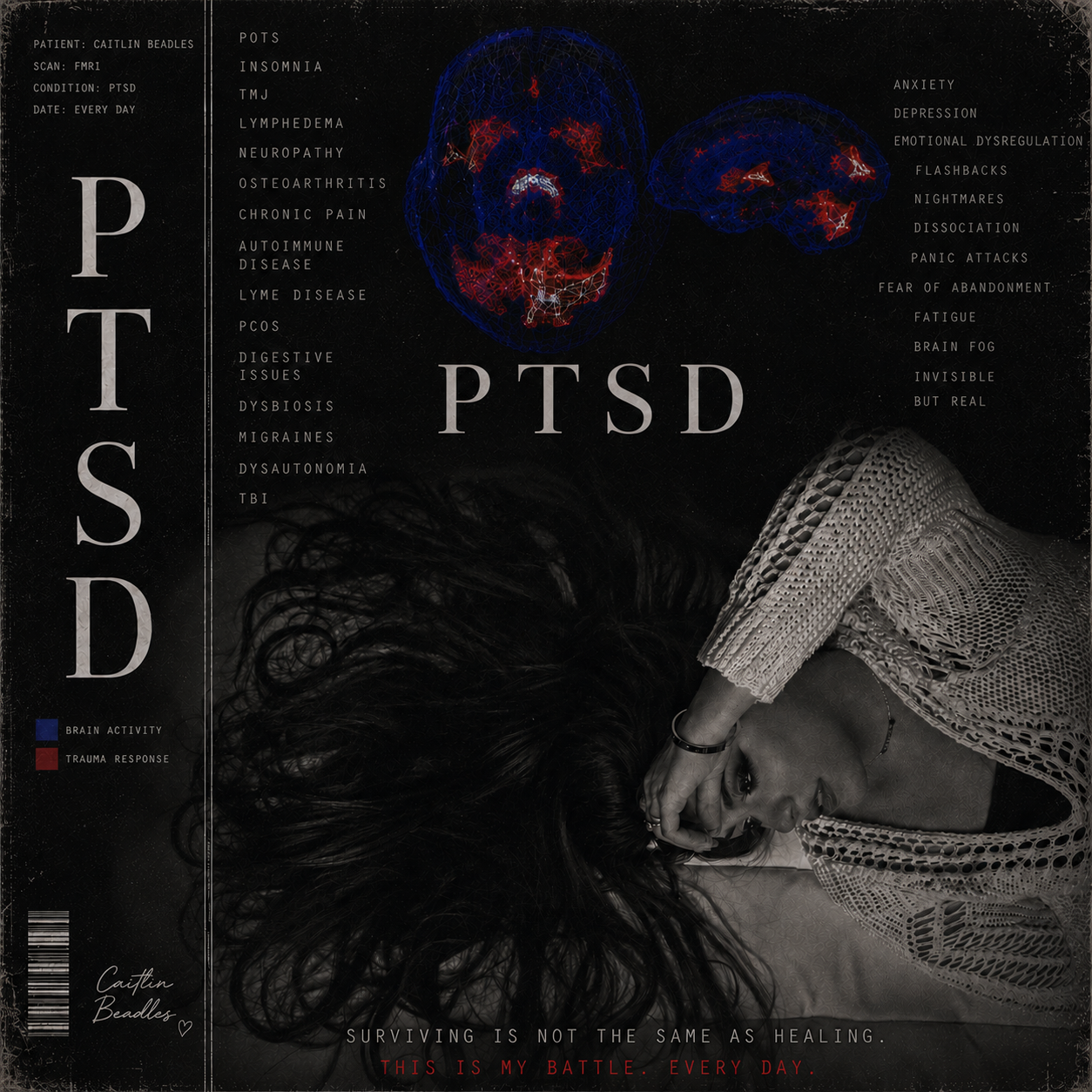 PTSD